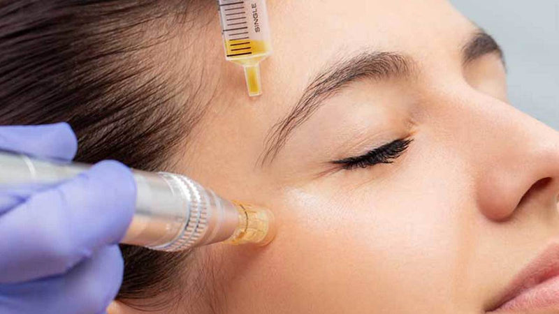 Aesthetic Service- Microneedling with PRP
